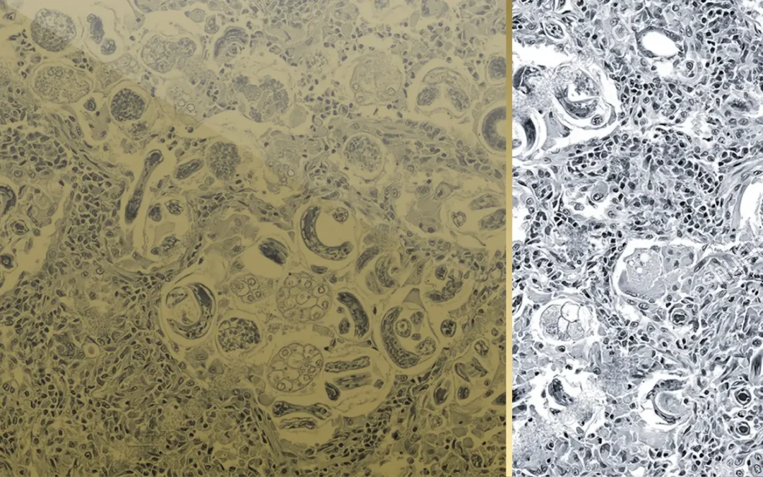 Lab Diagnostics: Haematology